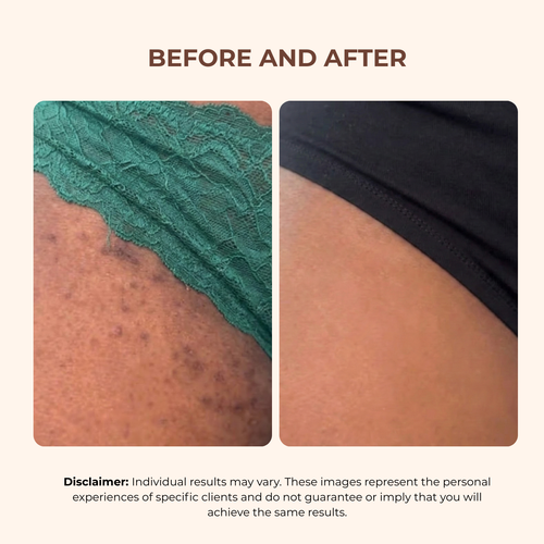 Bright Bikini Line Serum